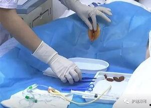 女患者导尿视频,专业护理操作演示